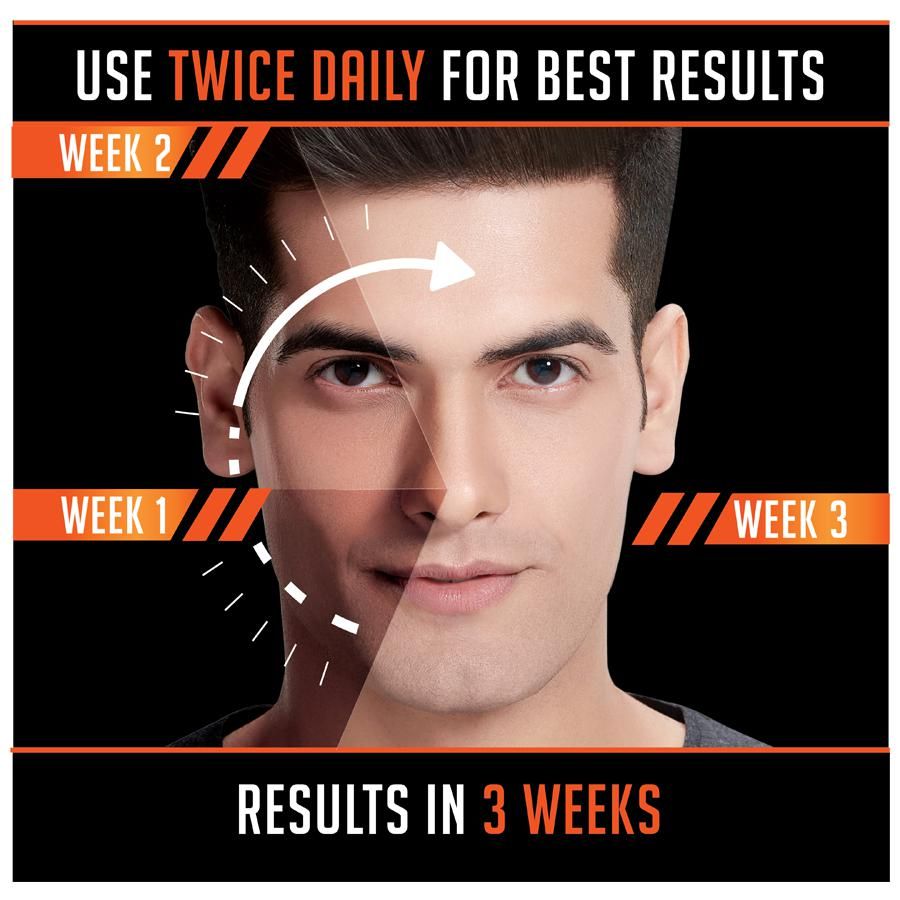 Emami Fair and Handsome  Radiance Face Cream - 30 g