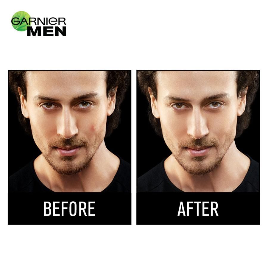 Garnier Men Acno Fight Pimple Clearing Whitening Cream - 45 g